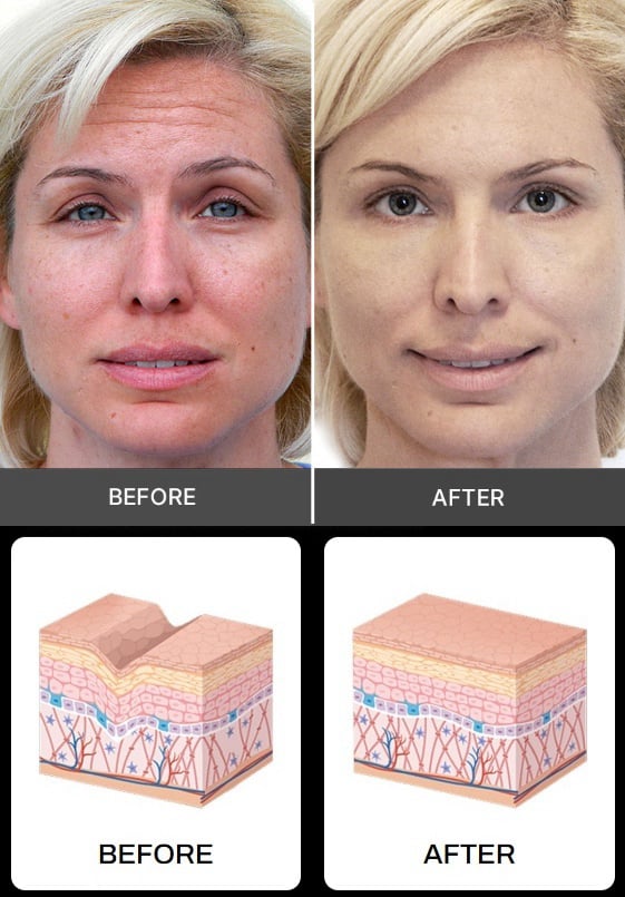 How-Does-Idrotherapy-Works?